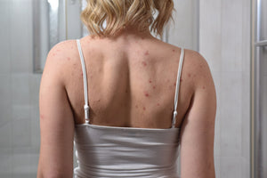Current skin condition